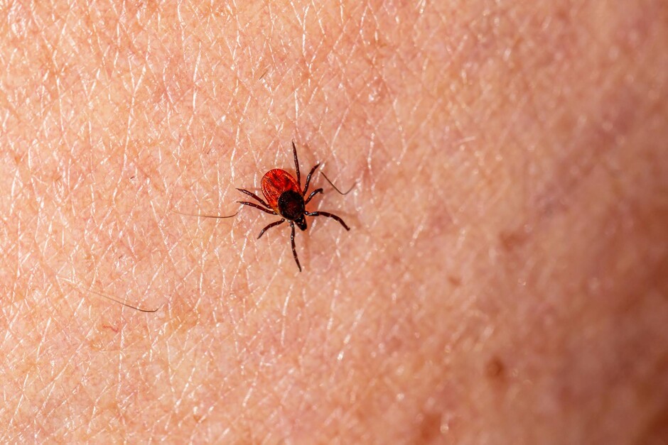 The image shows a tick on human skin.